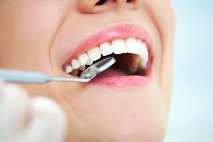 Comment bien entretenir ses dents?