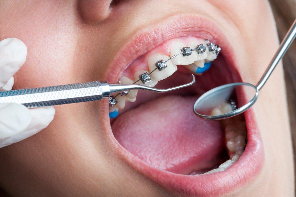 Orthodontiste