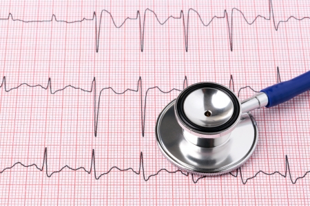 Cardiologue interventionnel