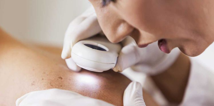 Dermatologie : quels sont les différents types de peaux ?