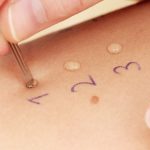 Dermatologue : ses méthodes de traitement !