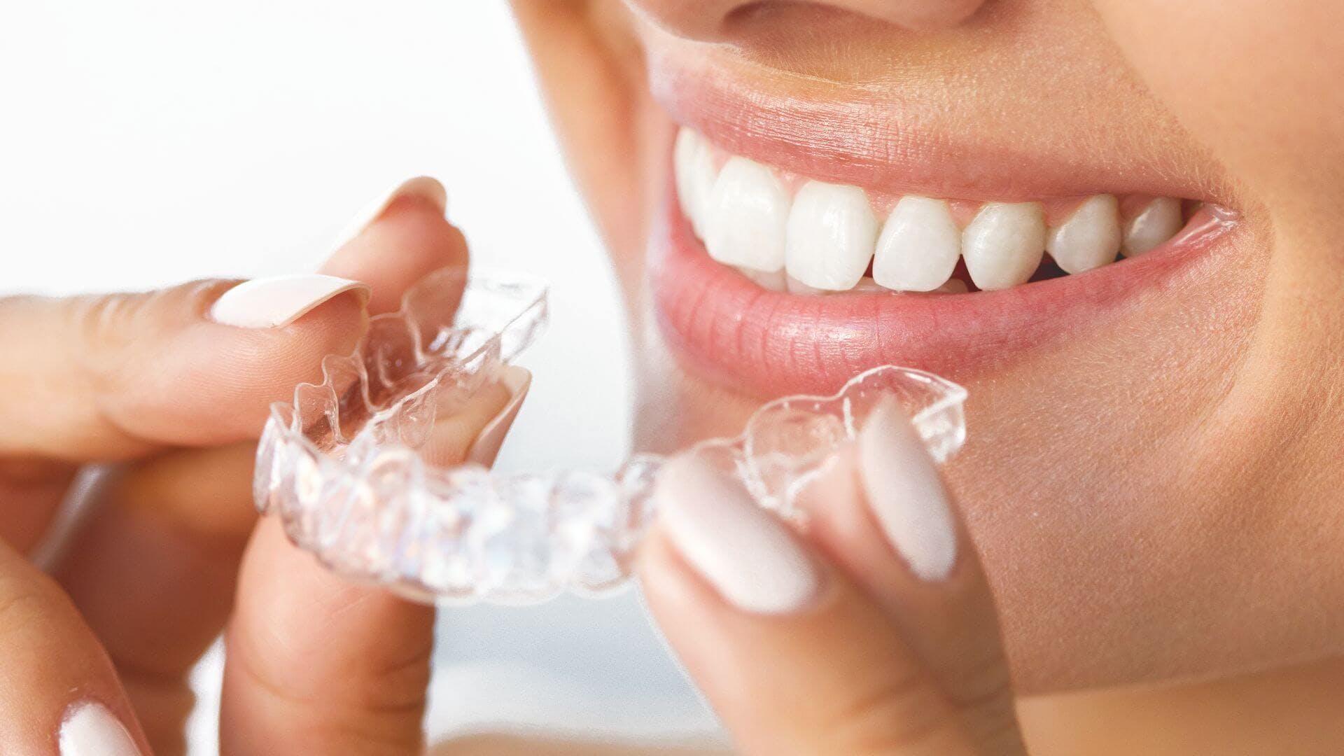 Easysmiles, la startup qui révolutionne l’orthodontie !