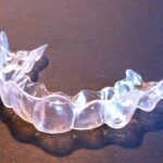 Porter un appareil dentaire invisible : zoom sur les gouttières dentaires
