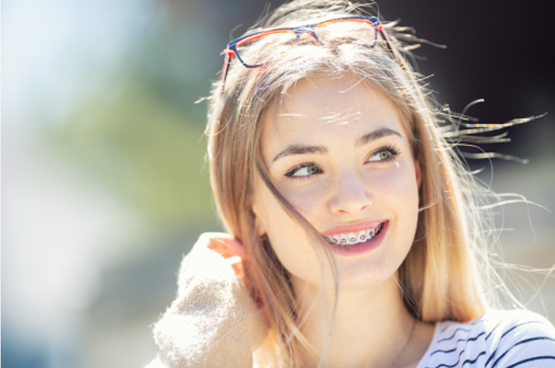 Qu’est-ce que l’orthodontie linguale ?