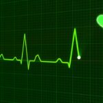 Comment fonctionnent les électrodes ECG ?