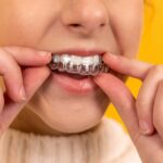 Aligneur dentaire : avantages et inconvénients